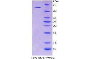 SDS-PAGE analysis of Human ALDH7A1 Protein. (ALDH7A1 Protein)