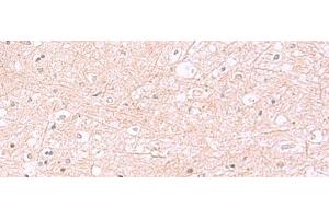 Immunohistochemistry of paraffin-embedded Human brain tissue using RABEPK Polyclonal Antibody at dilution of 1:85(x200) (RABEPK Antikörper)