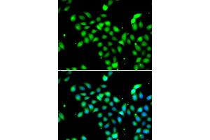 Immunofluorescence analysis of A549 cell using METTL13 antibody. (METTL13 Antikörper)