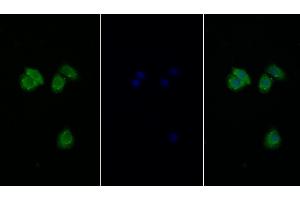 Detection of EIF2aK3 in Human Hela cell using Polyclonal Antibody to Eukaryotic Translation Initiation Factor 2 Alpha Kinase 3 (EIF2aK3) (PERK Antikörper  (AA 973-1114))