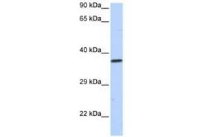 Image no. 1 for anti-Sex Comb On Midleg-Like 1 (SCML1) (AA 36-85) antibody (ABIN6740440) (SCML1 Antikörper  (AA 36-85))