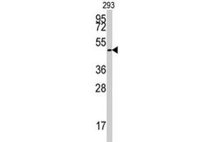 Western blot analysis of E2F1 polyclonal antibody  in 293 cell line lysates (35 ug/lane). (E2F1 Antikörper  (Ser332))