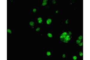 Immunofluorescent analysis of MCF-7 cells using ABIN7143011 at dilution of 1:100 and Alexa Fluor 488-congugated AffiniPure Goat Anti-Rabbit IgG(H+L) (PHAP1 Antikörper  (AA 1-170))
