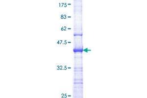 Image no. 1 for AXL Receptor tyrosine Kinase (AXL) (AA 30-140) protein (GST tag) (ABIN1346247)