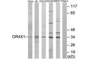 Western blot analysis of extracts from HeLa/Jurkat/HuvEc/MCF-7/COLO cells, using OR4X1 Antibody. (OR4X1 Antikörper  (AA 256-305))