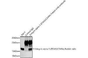 Immunoprecipitation analysis of 300 μg extracts of  cells using 3 μg Integrin alpha 5 (ITG/CD49e) antibody (ABIN7267936).