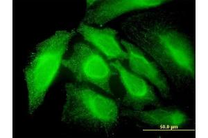 Immunofluorescence of monoclonal antibody to RNF14 on HeLa cell.