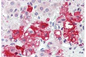 Human Adrenal (formalin-fixed, paraffin-embedded) stained with LASS6 antibody ABIN396945 at 5 ug/ml followed by biotinylated goat anti-rabbit IgG secondary antibody ABIN481713, alkaline phosphatase-streptavidin and chromogen. (CERS6 Antikörper  (N-Term))