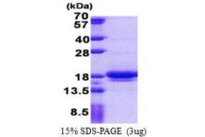 LIM Domain Containing 2 (LIMD2) (AA 1-127) protein (His tag)