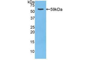 Western blot analysis of recombinant Rat CTSD. (Cathepsin D Antikörper  (AA 120-407))