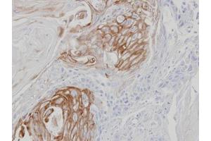 IHC-P Image Immunohistochemical analysis of paraffin-embedded SCC25 xenograft, using ZPBP, antibody at 1:100 dilution. (ZPBP Antikörper)