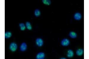 Detection of NPM1 in Human MCF7 Cell using Polyclonal Antibody to Nucleophosmin 1 (NPM1) (NPM1 Antikörper  (AA 212-292))