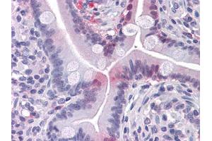 Immunohistochemical analysis of paraffin-embedded human Small Intestine tissues using FABP2 mouse mAb (FABP2 Antikörper)