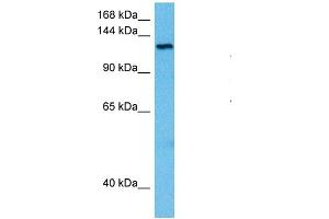 Host:  Rat  Target Name:  TRPM4  Sample Tissue:  Rat Brain  Antibody Dilution:  1ug/ml (TRPM4 Antikörper  (N-Term))