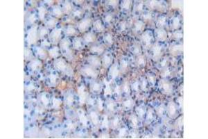 IHC-P analysis of Mouse Kidney Tissue, with DAB staining. (Albumin Antikörper)
