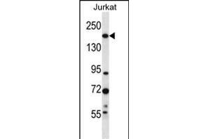 UGCGL1 Antibody (C-term) (ABIN657069 and ABIN2846232) western blot analysis in Jurkat cell line lysates (35 μg/lane). (UGGT1 Antikörper  (C-Term))