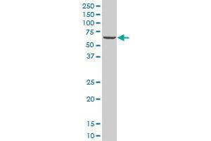 ZNF215 monoclonal antibody (M03), clone 1D12 Western Blot analysis of ZNF215 expression in A-431 . (ZNF215 Antikörper  (AA 1-304))