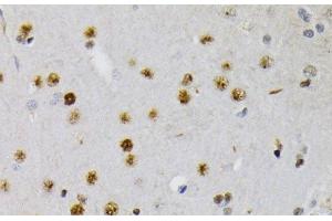 Immunohistochemistry of paraffin-embedded Rat brain using Phospho-CREB1(S133) Polyclonal Antibody at dilution of 1:200 (40x lens).