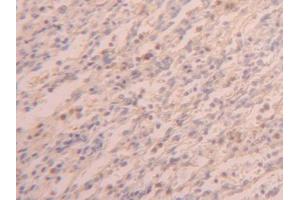 DAB staining on IHC-P; Samples: Human Spleen Tissue (PABPC1L Antikörper  (AA 187-368))
