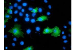 Anti-ARFGAP1 mouse monoclonal antibody (ABIN2454352) immunofluorescent staining of COS7 cells transiently transfected by pCMV6-ENTRY ARFGAP1 (RC206987). (ARFGAP1 Antikörper)