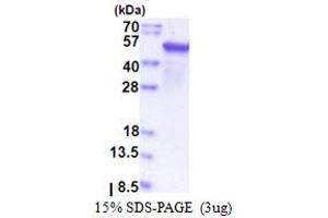 SDS-PAGE (SDS) image for Epoxide Hydrolase 1, Microsomal (Xenobiotic) (EPHX1) (AA 21-455) protein (T7 tag) (ABIN5853545)