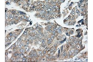 Immunohistochemical staining of paraffin-embedded Human Kidney tissue using anti-BDH2 mouse monoclonal antibody. (BDH2 Antikörper)