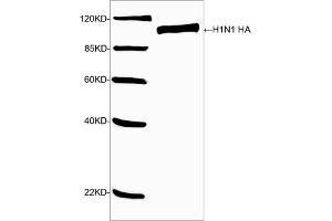 Western blot analysis of H1N1 HA recombinant protein using H1N1 HA Antibody (ABIN399080, 1 µg/mL) The signal was developed with IRDyeTM 800 Conjugated Goat Anti-Rabbit IgG. (Hemagglutinin Antikörper  (AA 200-250))