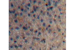 Used in DAB staining on fromalin fixed paraffin-embedded Liver tissue (Huntingtin Antikörper  (AA 782-920))
