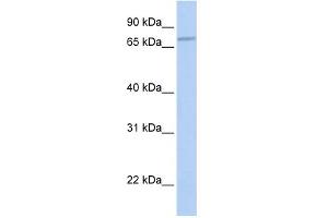 WB Suggested Anti-CABC1 Antibody Titration:  0. (COQ8A Antikörper  (N-Term))