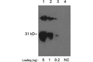 Lane 1-3: GST fusion protein in E. (GST Antikörper  (Biotin))