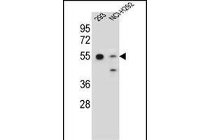 GNAS Antibody (C-term) (ABIN656989 and ABIN2850497) western blot analysis in 293,NCI- cell line lysates (35 μg/lane). (GNAS Antikörper  (C-Term))