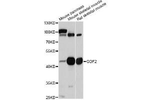 Western blot analysis of extracts of various cell lines, using GDF2 antibody (ABIN5997784) at 1/1000 dilution. (GDF2 Antikörper)