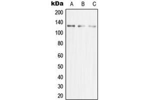 Western blot analysis of MCM2 expression in HeLa (A), Jurkat (B), HeLa (C) whole cell lysates. (MCM2 Antikörper  (N-Term))