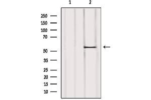 Western blot analysis of extracts from Mouse liver, using UGT2B7 Antibody. (UGT2B7 Antikörper)
