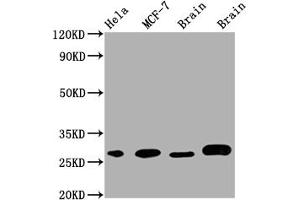Western Blot Positive WB detected in: Hela whole cell lysate, MCF-7 whole cell lysate, Mouse Brain whole cell lysate, Rat Brain whole cell lysate All lanes: GRB2 antibody at 1:1000 Secondary Goat polyclonal to rabbit IgG at 1/50000 dilution Predicted band size: 26, 21 kDa Observed band size: 28 kDa (Rekombinanter GRB2 Antikörper)