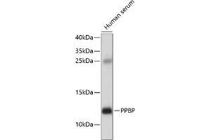 Western blot analysis of extracts of human serum, using PPBP antibody  at 1:1000 dilution. (CXCL7 Antikörper  (AA 31-128))