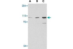 Western blot analysis of GRIK1 in P815 cell lysate with GRIK1 polyclonal antibody  at (A) 0. (GRIK1 Antikörper  (C-Term))