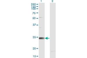 Western Blot analysis of RAB7B expression in transfected 293T cell line by RAB7B monoclonal antibody (M02A), clone 1C3. (RAB7B Antikörper  (AA 100-199))