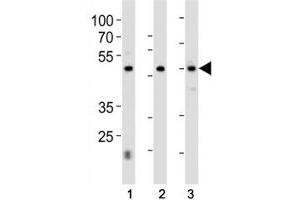Western Blotting (WB) image for anti-Hepatocyte Nuclear Factor 4, alpha (HNF4A) (AA 281-312) antibody (ABIN3031189)