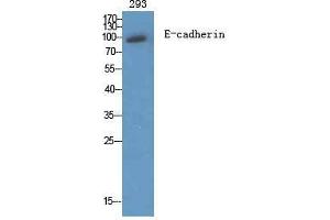 Western Blotting (WB) image for anti-Cadherin 1, Type 1, E-Cadherin (Epithelial) (CDH1) (C-Term) antibody (ABIN3184389)