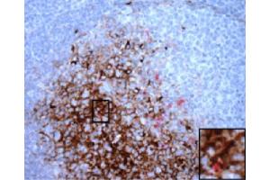 Paraffin embedded scrapie-infected sheep retropharyngeal lymph node section was stained with anti-120 kDa followed by Rat Anti-Mouse IgM-HRP (Ratte anti-Maus IgM (Chain mu) Antikörper (HRP))