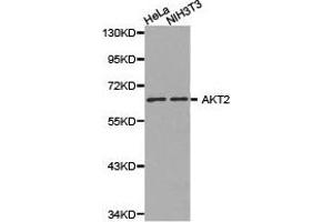 Western Blotting (WB) image for anti-V-Akt Murine Thymoma Viral Oncogene Homolog 2 (AKT2) antibody (ABIN1870912) (AKT2 Antikörper)