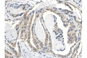 Immunohistochemistry (IHC) image for anti-Insulin-Like Growth Factor Binding Protein 2, 36kDa (IGFBP2) (AA 148-325) antibody (ABIN7430594)