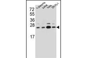 SSR2 Antibody (C-term) (ABIN657094 and ABIN2846252) western blot analysis in human placenta tissue and Jurkat,Hela,ZR-75-1 cell line lysates (35 μg/lane). (SSR2 Antikörper  (C-Term))