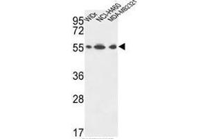 ATP5A1 Antibody (C-term) western blot analysis in WiDr,NCI-H460,MDA-MB231 cell line lysates (35µg/lane).