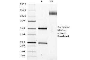 SDS-PAGE Analysis Purified CD25 Mouse Monoclonal Antibody (IL2RA/423). (CD25 Antikörper)