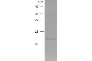 Chemokine (C-C Motif) Ligand 2 (CCL2) (AA 24-96) (Active) protein (His tag)