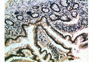 Immunohistochemical analysis of paraffin-embedded human-small-intestine, antibody was diluted at 1:200 (IL17B Antikörper  (AA 1-50))