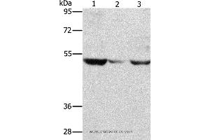 Western blot analysis of PC3 cell and mouse muscle tissue, A375 cell, using MMP1 Polyclonal Antibody at dilution of 1:500 (MMP1 Antikörper)