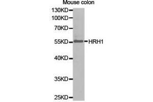 Western Blotting (WB) image for anti-Histamine Receptor H1 (HRH1) antibody (ABIN1873083) (HRH1 Antikörper)